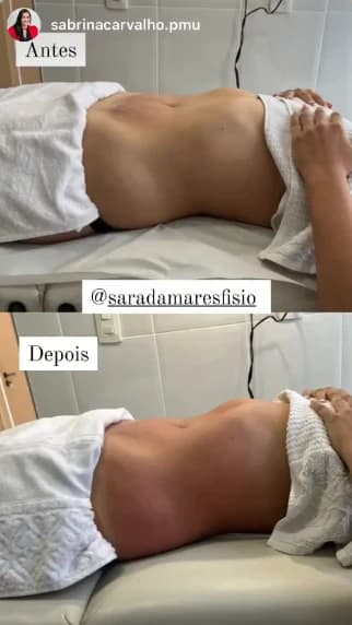 Story de Sabrina com registro antes e depois no atendimento presencial
